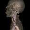 GE’s new CT scanner.jpg