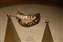 George Washington’s yellowed teeth.jpg